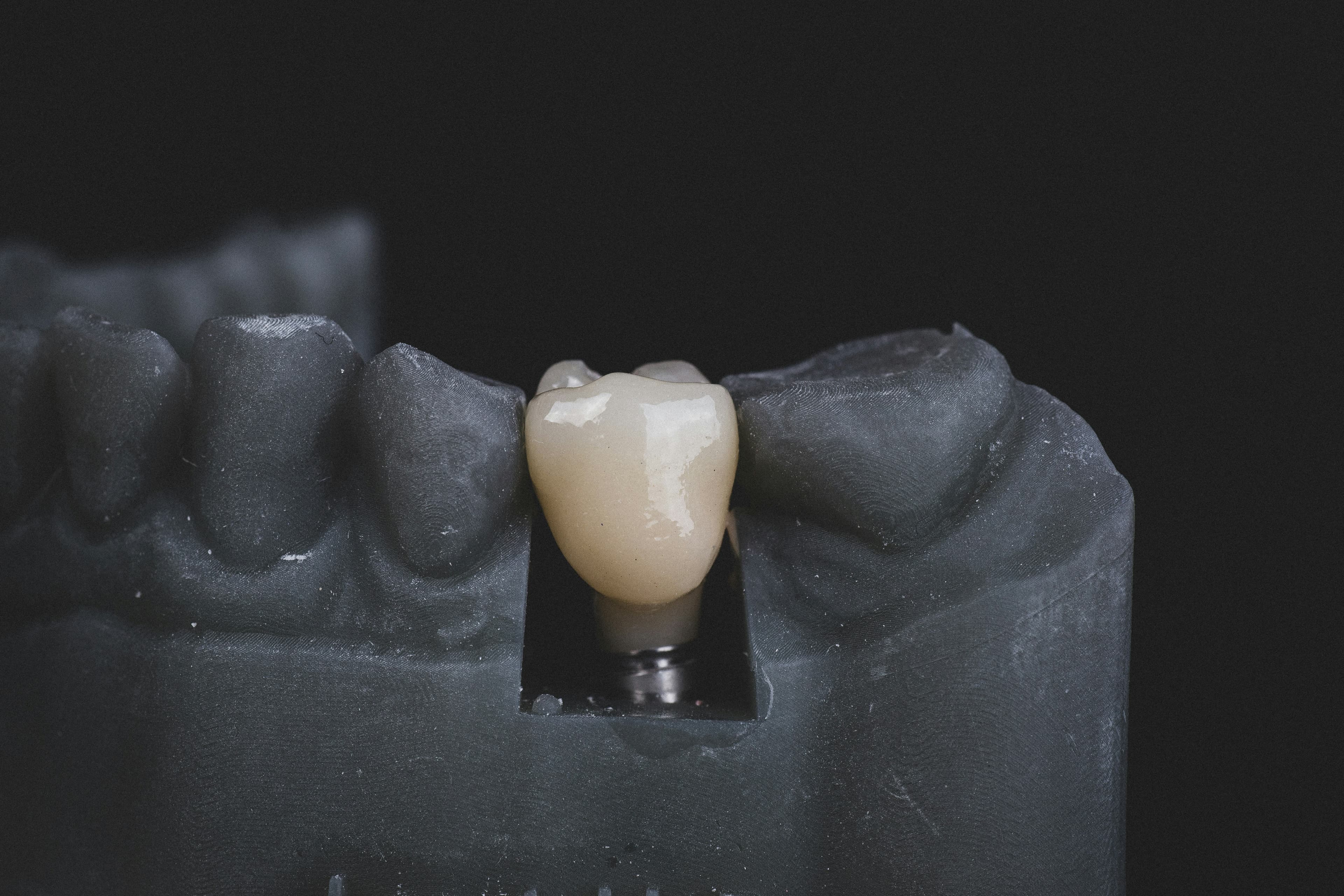 Ceramic Crowns